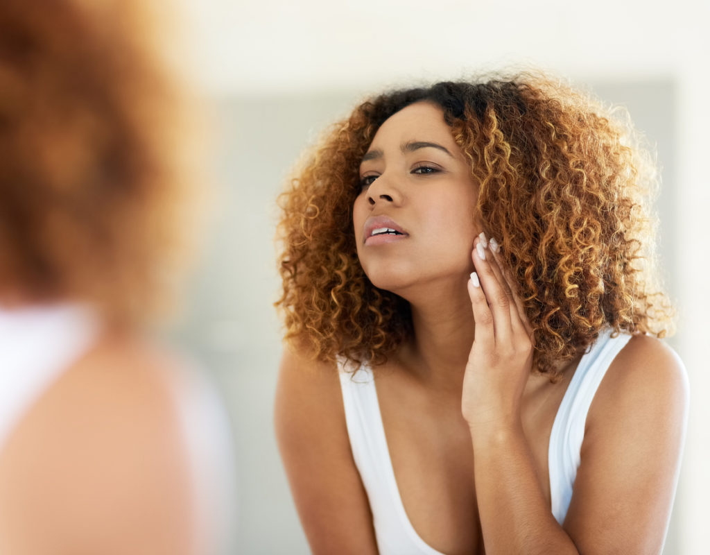 SA women's most troublesome skin condition